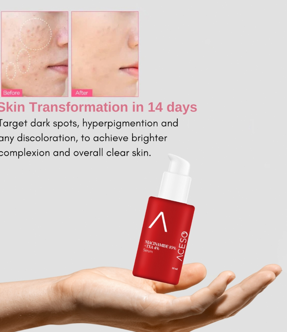 Serum z Niacynamidem 10%, TXA 4% 30ml